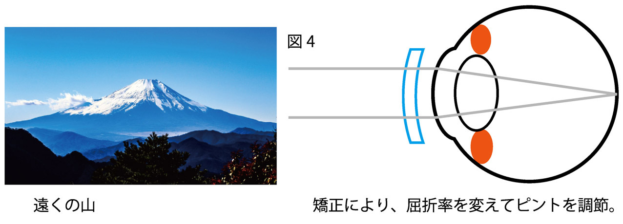 近視のメカニズム4