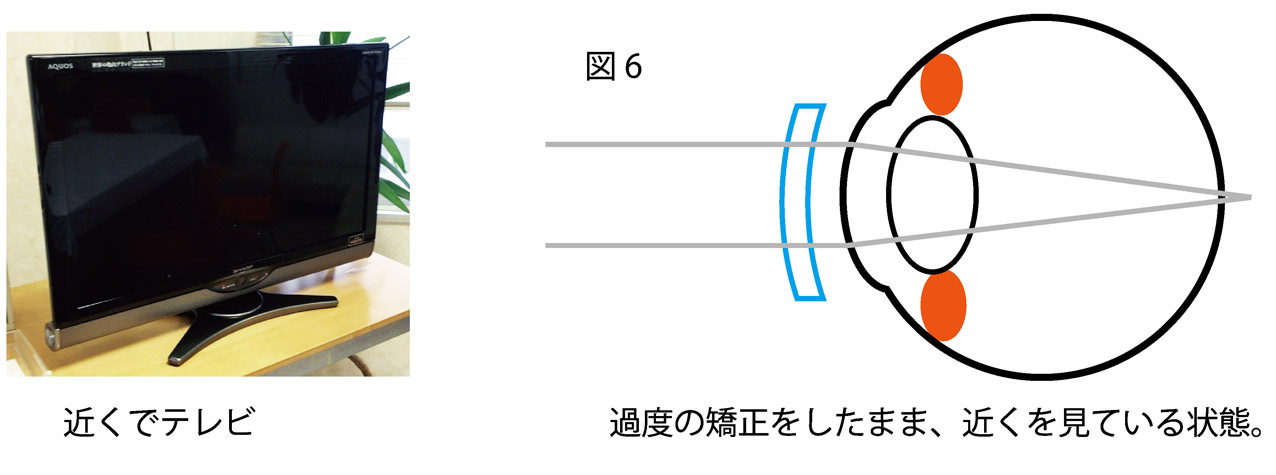 近視のメカニズム6